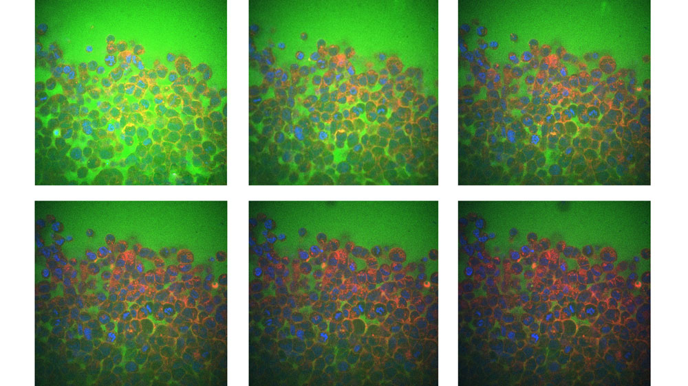 A sequence showing cells with different amounts of fluid between them