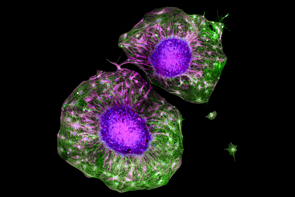 2 textured green ball-shaped neurons have a purple center and encased in veiny green lines.