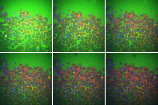 6 images of cells in different densities
