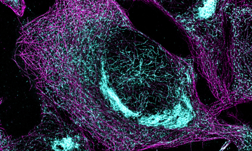 Microscopic view of tau in colorized sample
