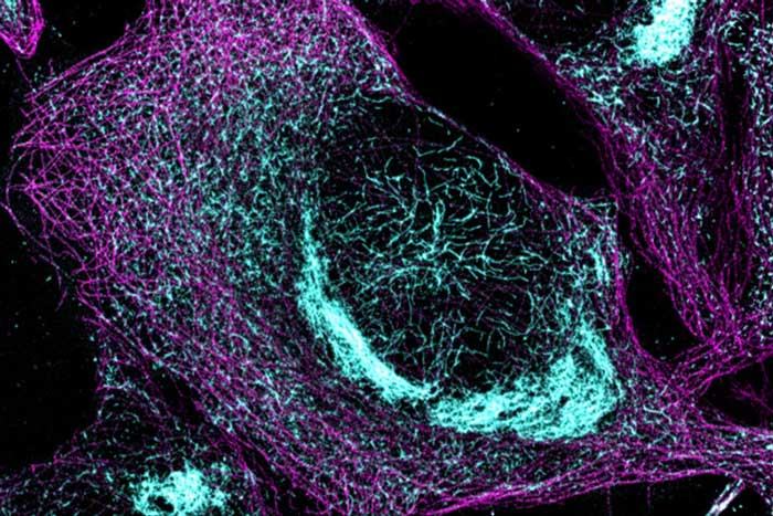 microscopic view of teal-stained tau